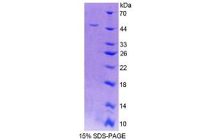 SDS-PAGE (SDS) image for Riboflavin Kinase (RFK) (AA 1-155) protein (His tag,GST tag) (ABIN6237204) (Riboflavin Kinase Protein (RFK) (AA 1-155) (His tag,GST tag))