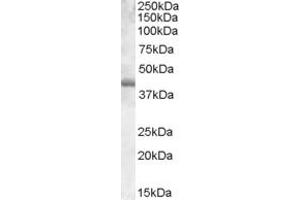 Western Blotting (WB) image for anti-Spleen Focus Forming Virus (SFFV) Proviral Integration Oncogene Spi1 (SPI1) (Internal Region) antibody (ABIN334471)