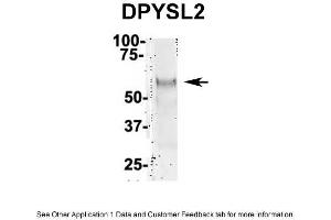 IP Suggested Anti-DPYSL2 Antibody Positive Control: NT2 CELL/BRAIN TISSUE (DPYSL2 Antikörper  (Middle Region))