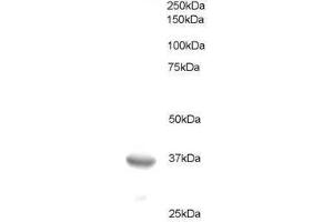 Image no. 1 for anti-B-Cell CLL/lymphoma 7A (BCL7A) (C-Term) antibody (ABIN374064) (BCL7A Antikörper  (C-Term))