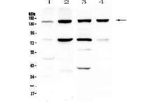 Western blot analysis of Integrin alpha 5 using anti-Integrin alpha 5 antibody . (ITGA5 Antikörper  (AA 42-263))