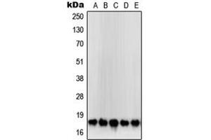 Western blot analysis of SOD1 expression in HeLa (A), MCF7 (B), Jurkat (C), HepG2 (D), DU145 (E) whole cell lysates. (SOD1 Antikörper  (Center))
