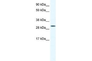 Human Jurkat; WB Suggested Anti-SOX12 Antibody Titration: 0. (SOX12 Antikörper  (C-Term))