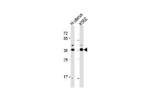 Western Blot at 1:1000 dilution Lane 1: human uterus lysate Lane 2: K562 whole cell lysate Lysates/proteins at 20 ug per lane. (OR52H1 Antikörper  (C-Term))