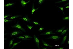 Immunofluorescence of purified MaxPab antibody to CUGBP1 on HeLa cell.