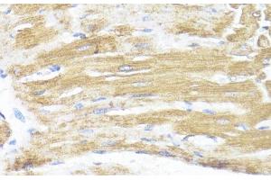 Immunohistochemistry of paraffin-embedded Rat heart using ASMT Polyclonal Antibody at dilution of 1:100 (40x lens).