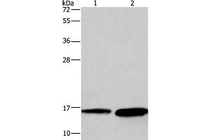 Western Blot analysis of Mouse heart and Human hepatocellular carcinoma tissue using HINT2 Polyclonal Antibody at dilution of 1:300 (HINT2 Antikörper)