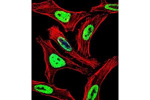 Fluorescent confocal image of Hela cell stained with EWSR1 Antibody . (EWSR1 Antikörper  (C-Term))