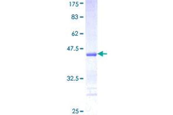 DAPK3 Protein (AA 355-454) (GST tag)