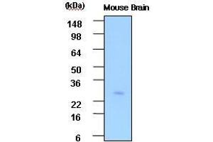 The extracts of Mouse brain(30 ug) were resolved by SDS-PAGE, transferred to PVDF membrane and probed with anti-human PSP (1:1,000). (STXBP3 Antikörper  (AA 1-225))