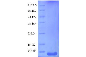 SDS-PAGE (SDS) image for Chemokine (C-X-C Motif) Ligand 10 (CXCL10) (AA 22-98), (full length) protein (His tag) (ABIN1046707)