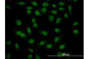 Immunofluorescence of monoclonal antibody to SURB7 on HeLa cell. (MED21 Antikörper  (AA 1-144))