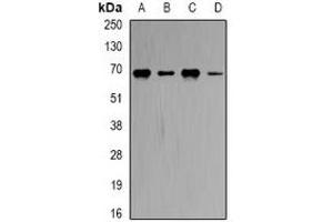 Western blot analysis of CBS expression in Hela (A), MCF7 (B), Romas (C), mouse brain (D) whole cell lysates. (CBS Antikörper)