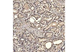 IHC analysis of SNRPA1 using anti-SNRPA1 antibody (ABIN7599131). (SNRPA1 Antikörper  (AA 1-233))