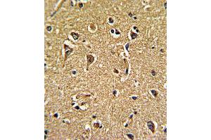 Immunohistochemistry (IHC) image for anti-Calcium Channel, Voltage-Dependent, gamma Subunit 5 (CACNG5) antibody (ABIN3002719)