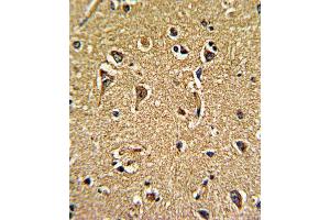 Immunohistochemistry (IHC) image for anti-Calcium Channel, Voltage-Dependent, gamma Subunit 5 (CACNG5) antibody (ABIN3002719) (CACNG5 Antikörper)