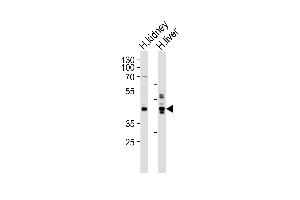 Western Blotting (WB) image for anti-Septin 9 (SEPT9) (AA 57-85), (C-Term) antibody (ABIN390155)