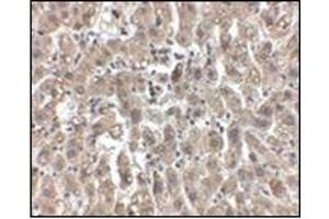 Immunohistochemistry of LDL-R in human liver tissue with this product at 2. (LDLR Antikörper  (Center))