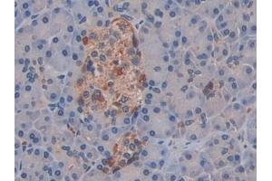 Immunohistochemistry (IHC) image for anti-C-Ros Oncogene 1 , Receptor tyrosine Kinase (ROS1) (AA 1945-2222) antibody (ABIN7442438)