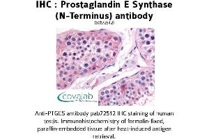 Image no. 1 for anti-Prostaglandin E Synthase (PTGES) (N-Term) antibody (ABIN1738425) (Prostaglandin E Synthase Antikörper  (N-Term))