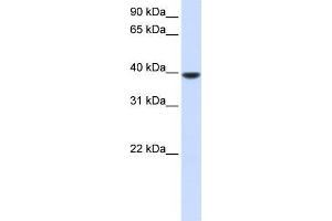 Human Muscle; WB Suggested Anti-AGPAT5 Antibody Titration: 0.