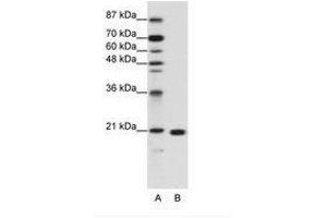 Image no. 1 for anti-Ribosomal Protein L9 (RPL9) (C-Term) antibody (ABIN203024) (RPL9 Antikörper  (C-Term))