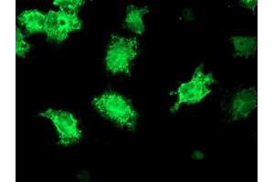 Anti-KATNB1 mouse monoclonal antibody (ABIN2455204) immunofluorescent staining of COS7 cells transiently transfected by pCMV6-ENTRY KATNB1 (RC201852). (KATNB1 Antikörper)