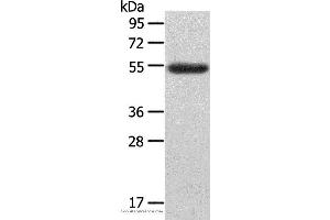 Western blot analysis of Human ovarian cancer tissue, using LAG3 Polyclonal Antibody at dilution of 1:148 (LAG3 Antikörper)