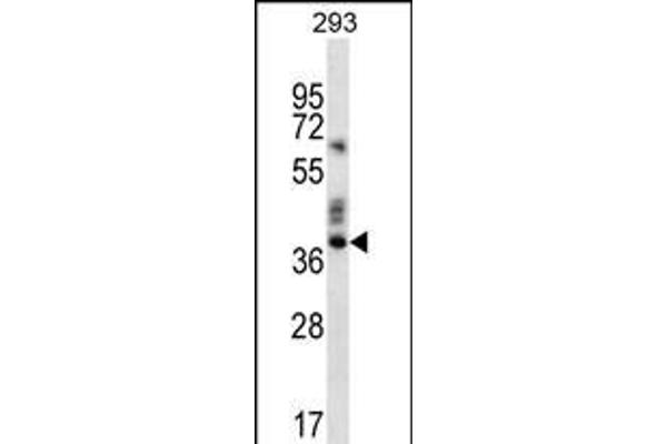 OR9K2 antibody  (C-Term)