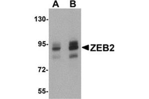 Western blot analysis of ZEB2 in Jurkat cell lysate with ZEB2 antibody at (A) 1 and (B) 2 μg/ml. (ZEB2 Antikörper  (C-Term))