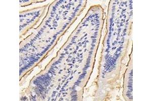 Immunohistochemistry analysis of paraffin-embedded mouse small intestine using ASAH2 (ABIN7074749) at dilution of 1:4200 (ASAH2 Antikörper)