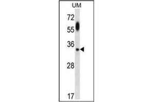 Western blot analysis using ATG5 Antibody  in UM cell line lysates (35ug/lane). (ATG5 Antikörper)