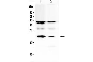 Western blot analysis of IL11 using anti-IL11 antibody .