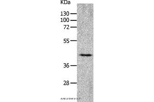 Western blot analysis of Mouse heart tissue, using CHRFAM7A Polyclonal Antibody at dilution of 1:700 (CHRNA7 Antikörper)