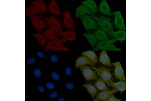 ABIN6258574 and ABIN6275343 staining Hela cells(45 min of heat-shock) by IF/ICC. (DECR2 Antikörper  (Internal Region))