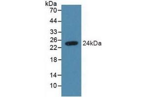 Detection of Recombinant SDC4, Human using Polyclonal Antibody to Syndecan 4 (SDC4) (SDC4 Antikörper  (AA 18-145))