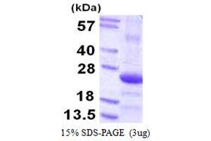 SDS-PAGE (SDS) image for COP9 Signalosome Subunit 8 (COPS8) (AA 1-209) protein (His tag) (ABIN667600)