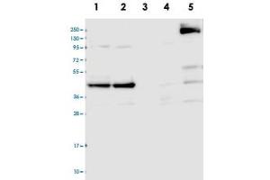 Western blot analysis of Lane 1: RT-4, Lane 2: U-251 MG, Lane 3: Human Plasma, Lane 4: Liver, Lane 5: Tonsil with CCDC94 polyclonal antibody  at 1:100-1:250 dilution. (CCDC94 Antikörper)
