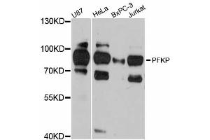 Western blot analysis of extracts of various cell lines, using PFKP antibody. (PFKP Antikörper)