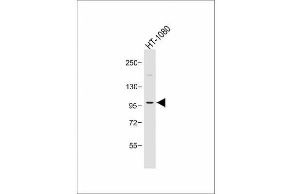 PIK3CD Antikörper  (C-Term)