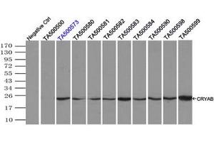 Image no. 2 for anti-Crystallin, alpha B (CRYAB) antibody (ABIN1497645) (CRYAB Antikörper)