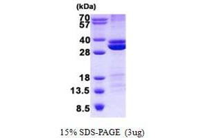 Image no. 1 for Ras Association (RalGDS/AF-6) Domain Family Member 3 (RASSF3) protein (His tag) (ABIN1098778)
