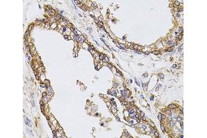 Immunohistochemistry of paraffin-embedded Human prostate using CAST Polyclonal Antibody at dilution of 1:100 (40x lens). (Calpastatin Antikörper)