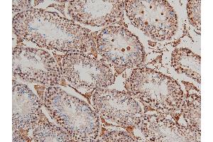 Immunohistochemistry (IHC) image for anti-LIM Domain Kinase 1 (LIMK1) (pThr508) antibody (ABIN6255701)
