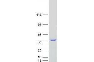 Western Blotting (WB) image for Small Nuclear Ribonucleoprotein Polypeptide A (SNRPA) (Active) protein (Myc-DYKDDDDK Tag) (ABIN2734735)