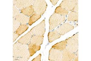 Immunohistochemistry of paraffin embedded rat skeletal muscle using ATP2A2 (ABIN7075545) at dilution of 1: 500 (400x lens) (SERCA2 ATPase Antikörper)
