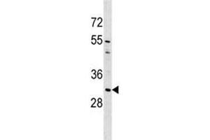 AQP1 antibody western blot analysis in A549 lysate