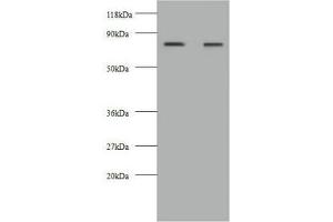 Western blot All lanes: KNG1 antibody at 2 μg/mL Lane 1: HepG2 whole cell lysate Lane 2: 293T whole cell lysate Secondary Goat polyclonal to rabbit IgG at 1/10000 dilution Predicted band size: 72, 48, 44 kDa Observed band size: 72 kDa (KNG1 Antikörper  (AA 390-644))