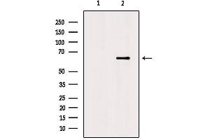 Netrin 1 anticorps  (C-Term)