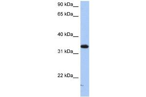 WB Suggested Anti-SULT6B1 Antibody Titration:  0. (SULT6B1 Antikörper  (C-Term))